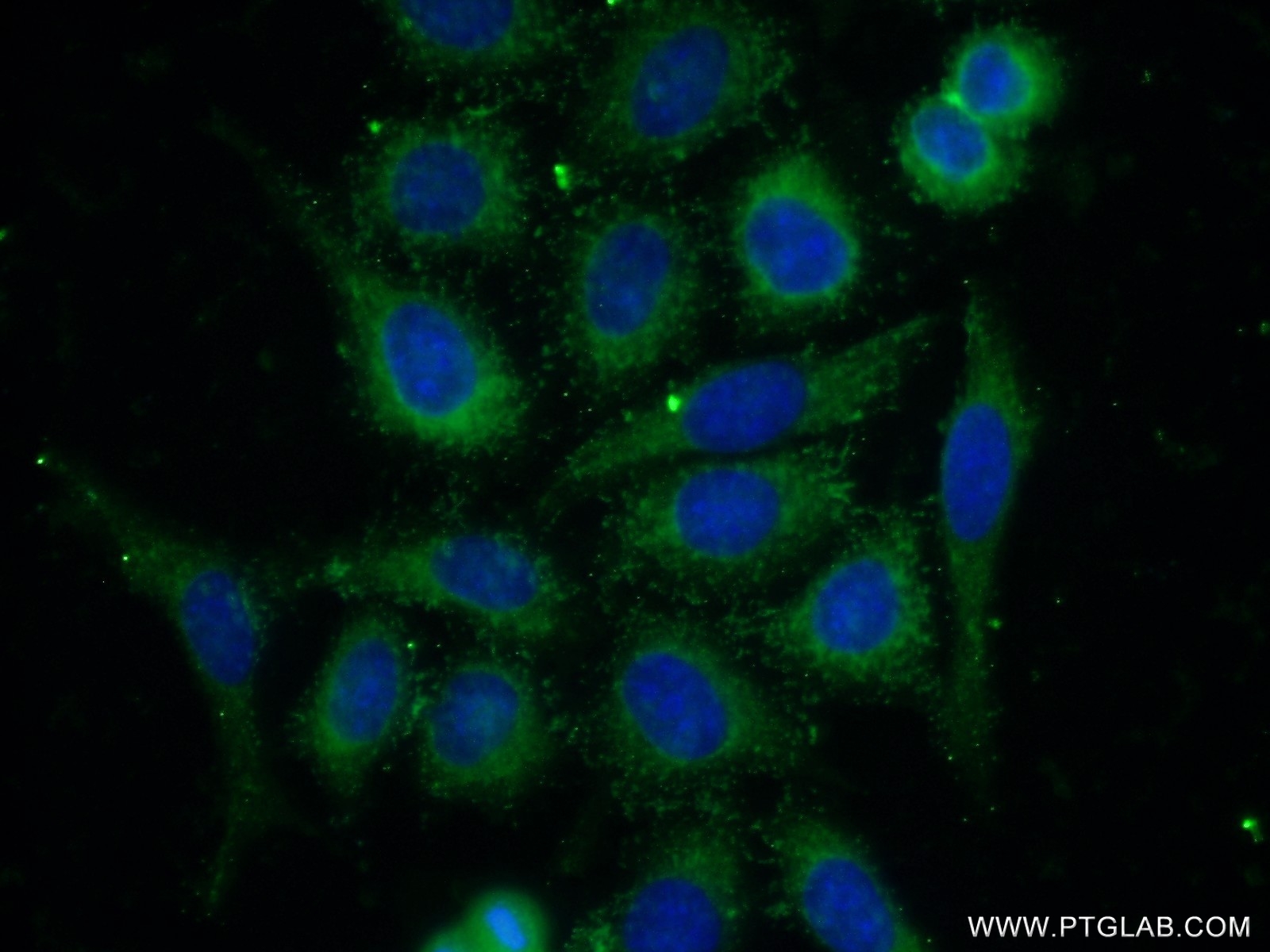 IF Staining of HeLa using 23885-1-AP