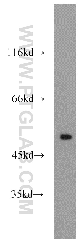 WB analysis of HeLa using 23885-1-AP