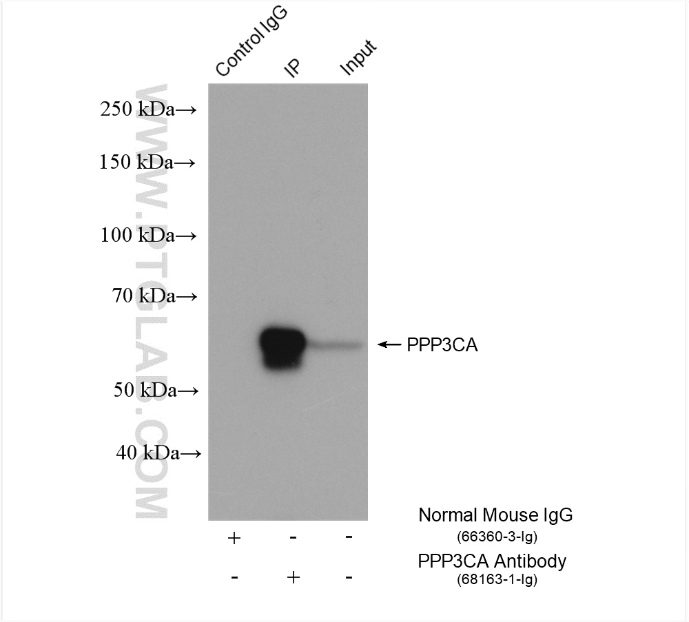 IP experiment of rat brain using 68163-1-Ig