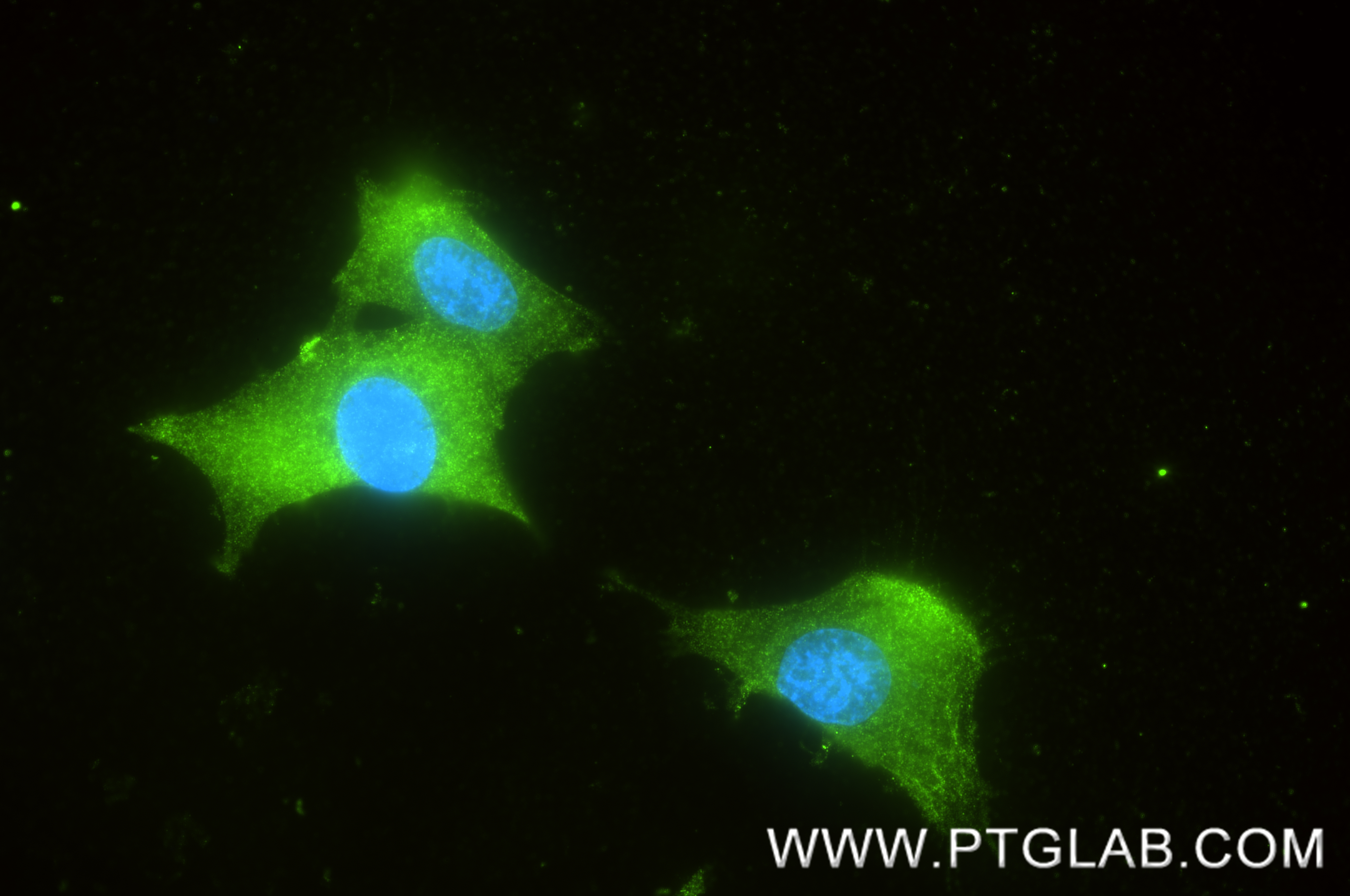 IF Staining of SH-SY5Y using 87902-1-RR IF Staining of SH-SY5Y using 87902-1-RR