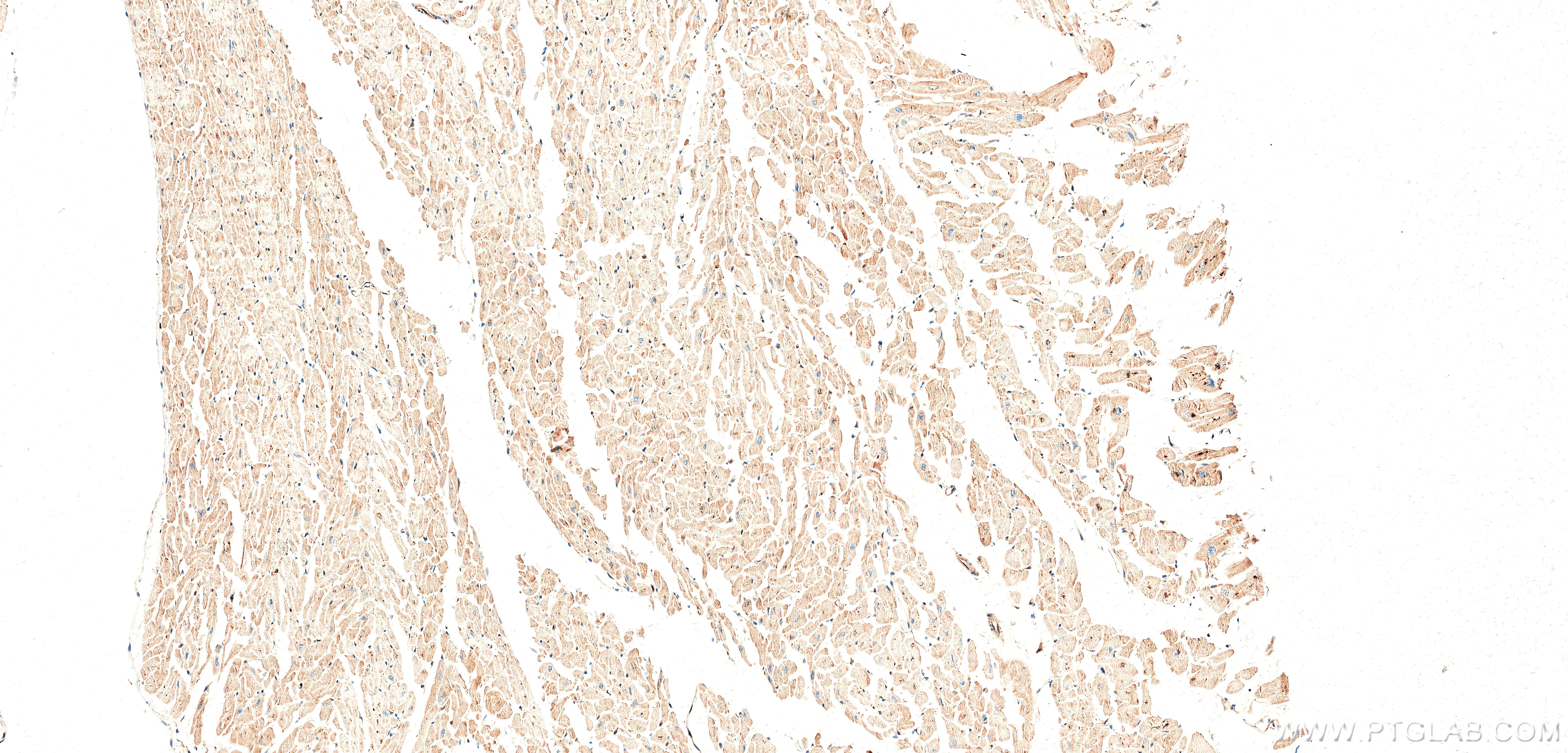IHC staining of human heart using 87902-1-RR IHC staining of human heart using 87902-1-RR