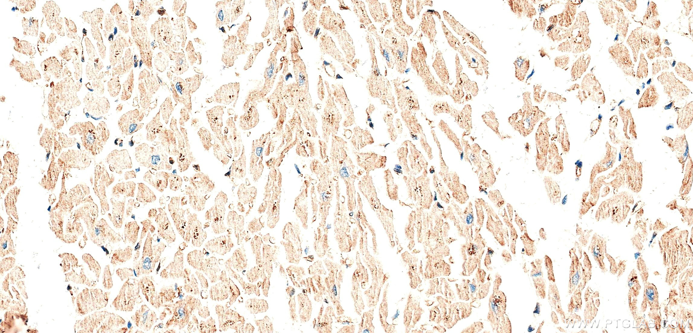 IHC staining of human heart using 87902-1-RR IHC staining of human heart using 87902-1-RR