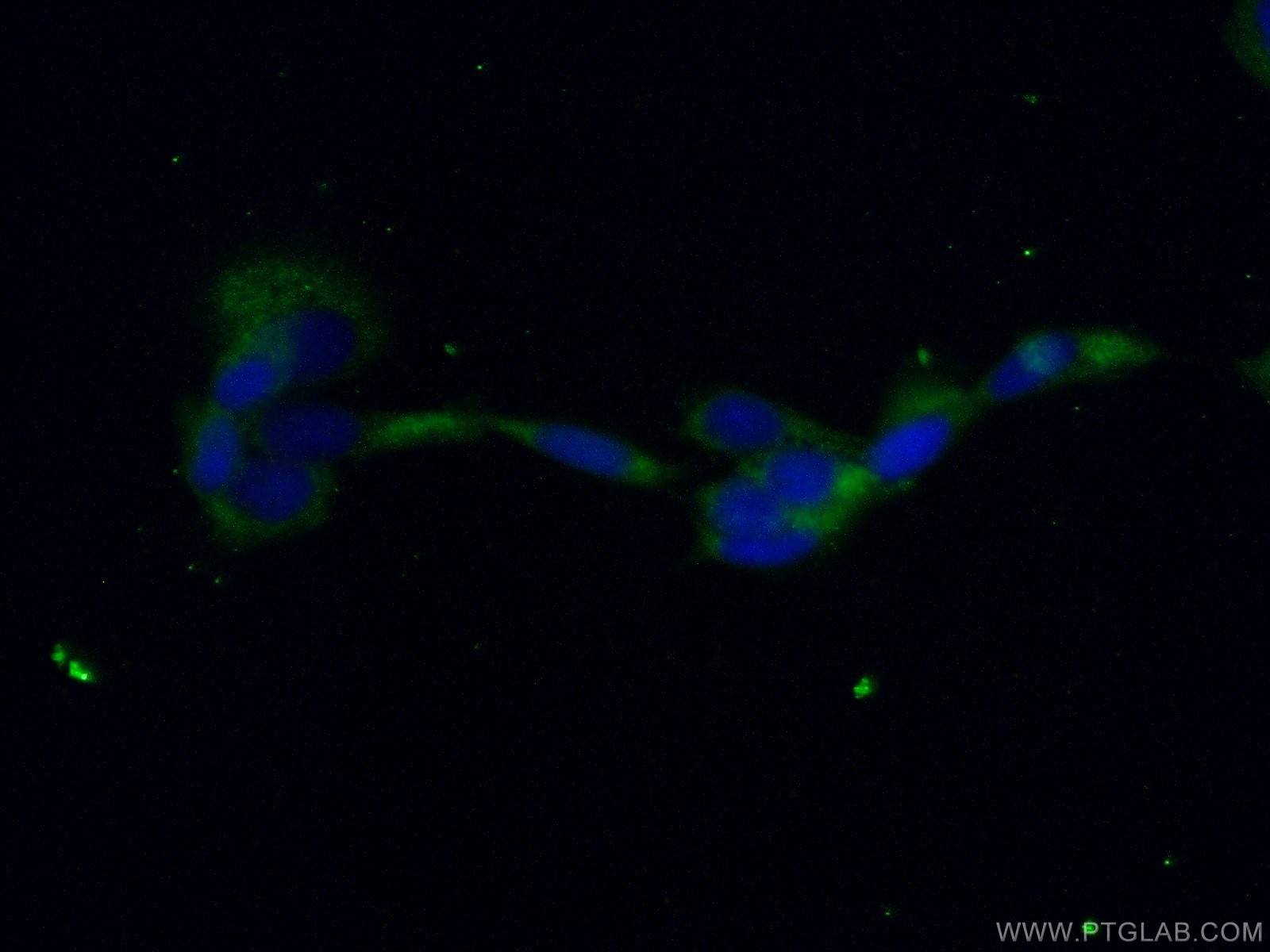 IF Staining of A431 using 55148-1-AP