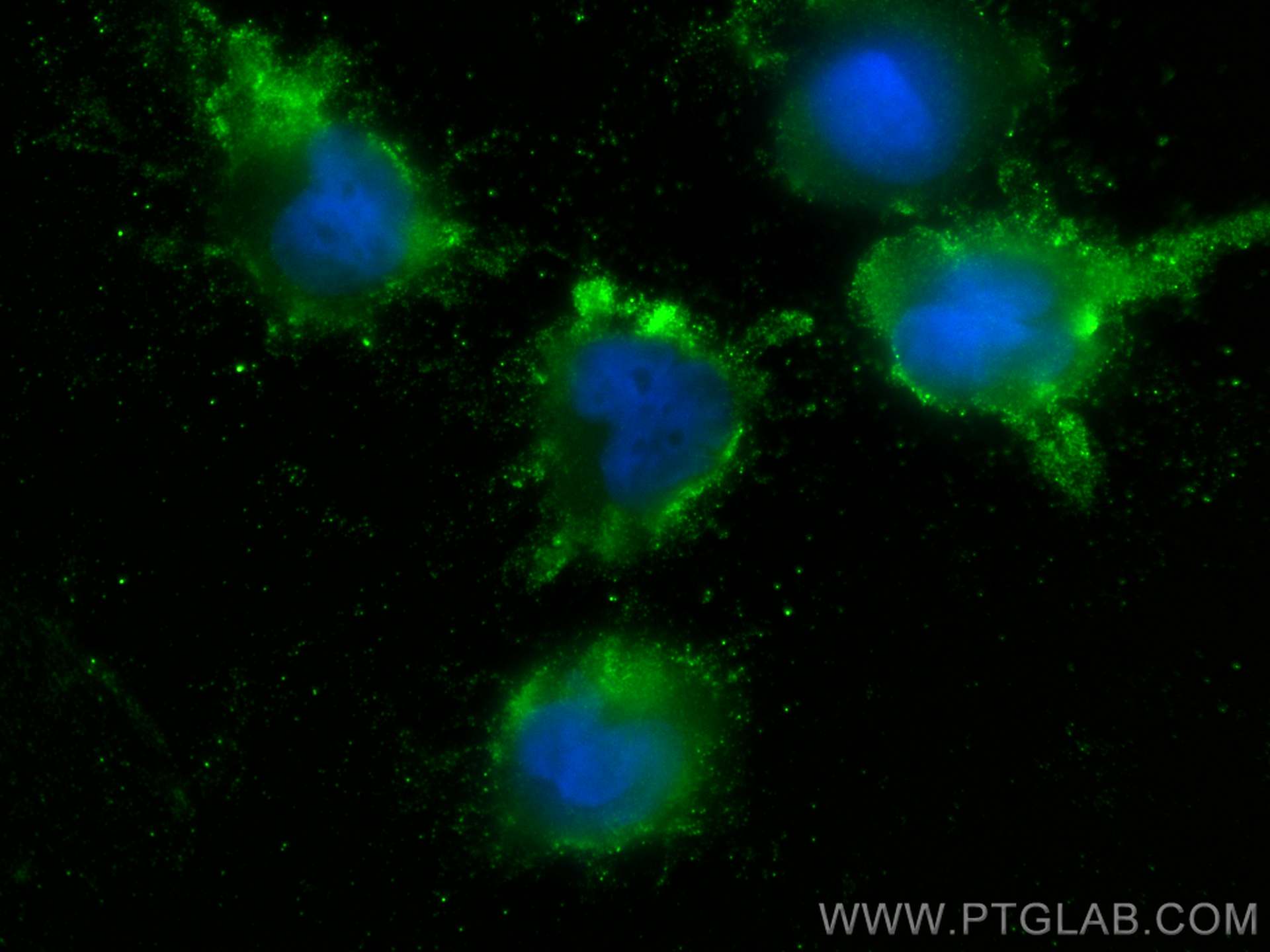 IF Staining of U-251 using 66614-1-Ig