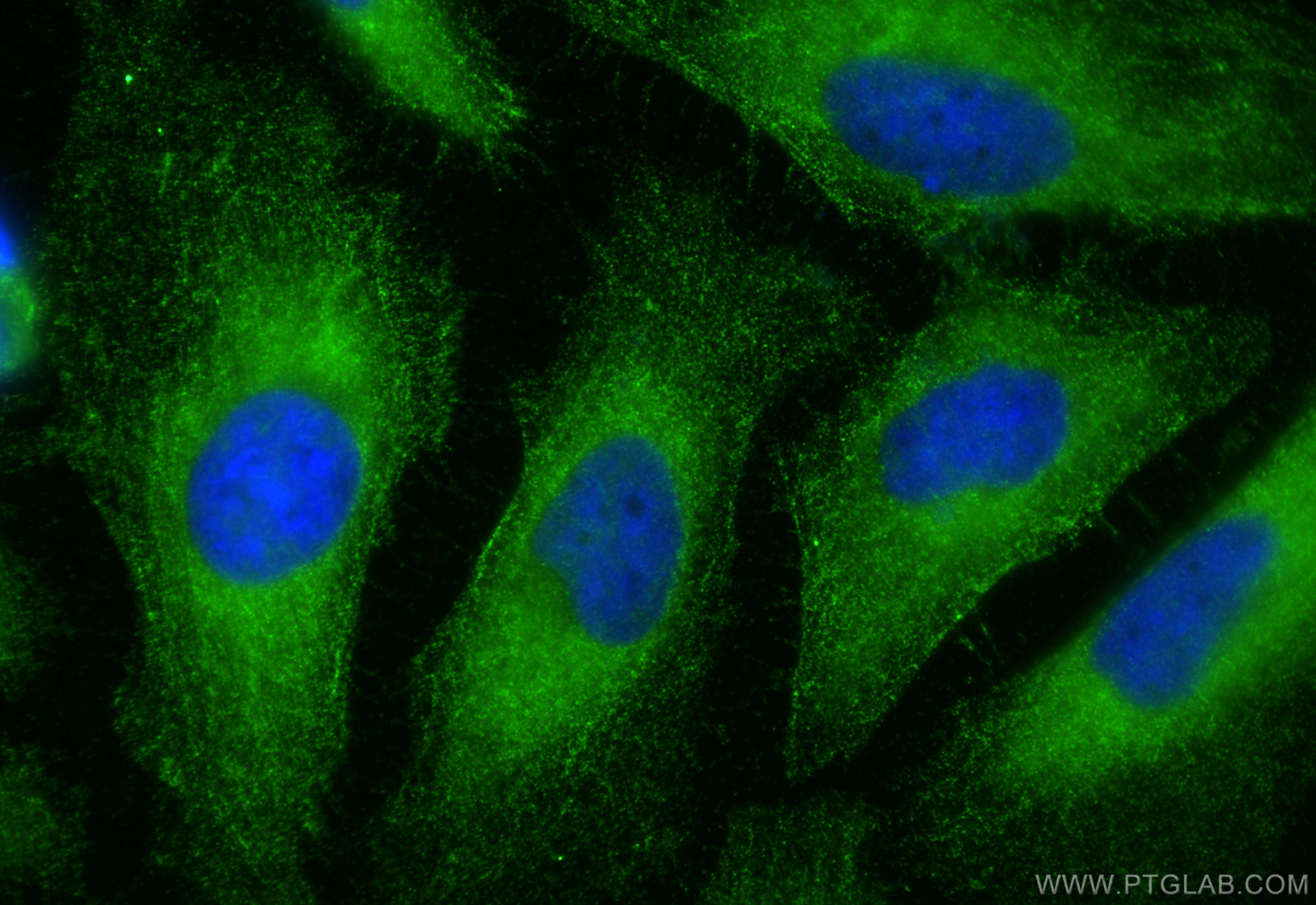 IF Staining of HeLa using 13210-1-AP