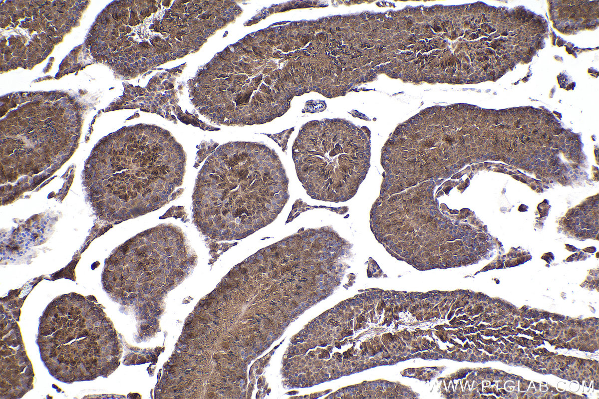 IHC staining of mouse testis using 13210-1-AP