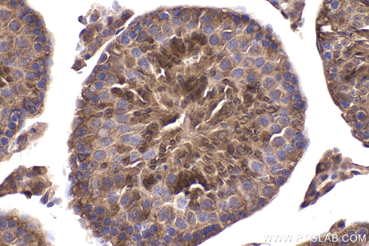 IHC staining of mouse testis using 13210-1-AP