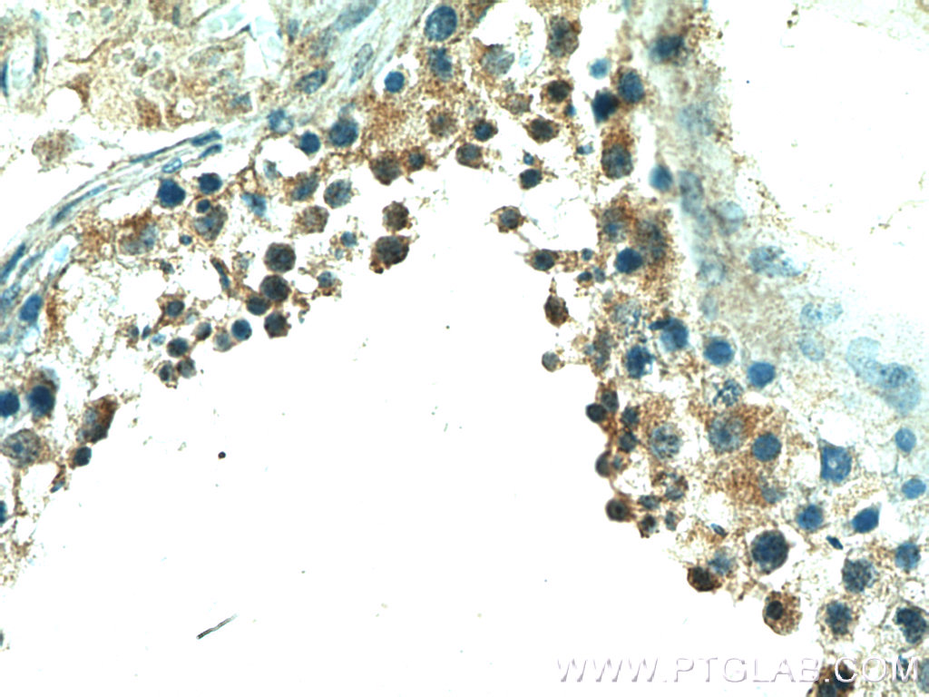 IHC staining of human testis using 14005-1-AP