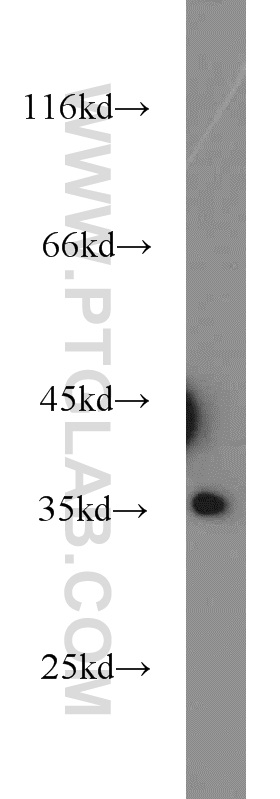 WB analysis of HEK-293 using 10262-1-AP