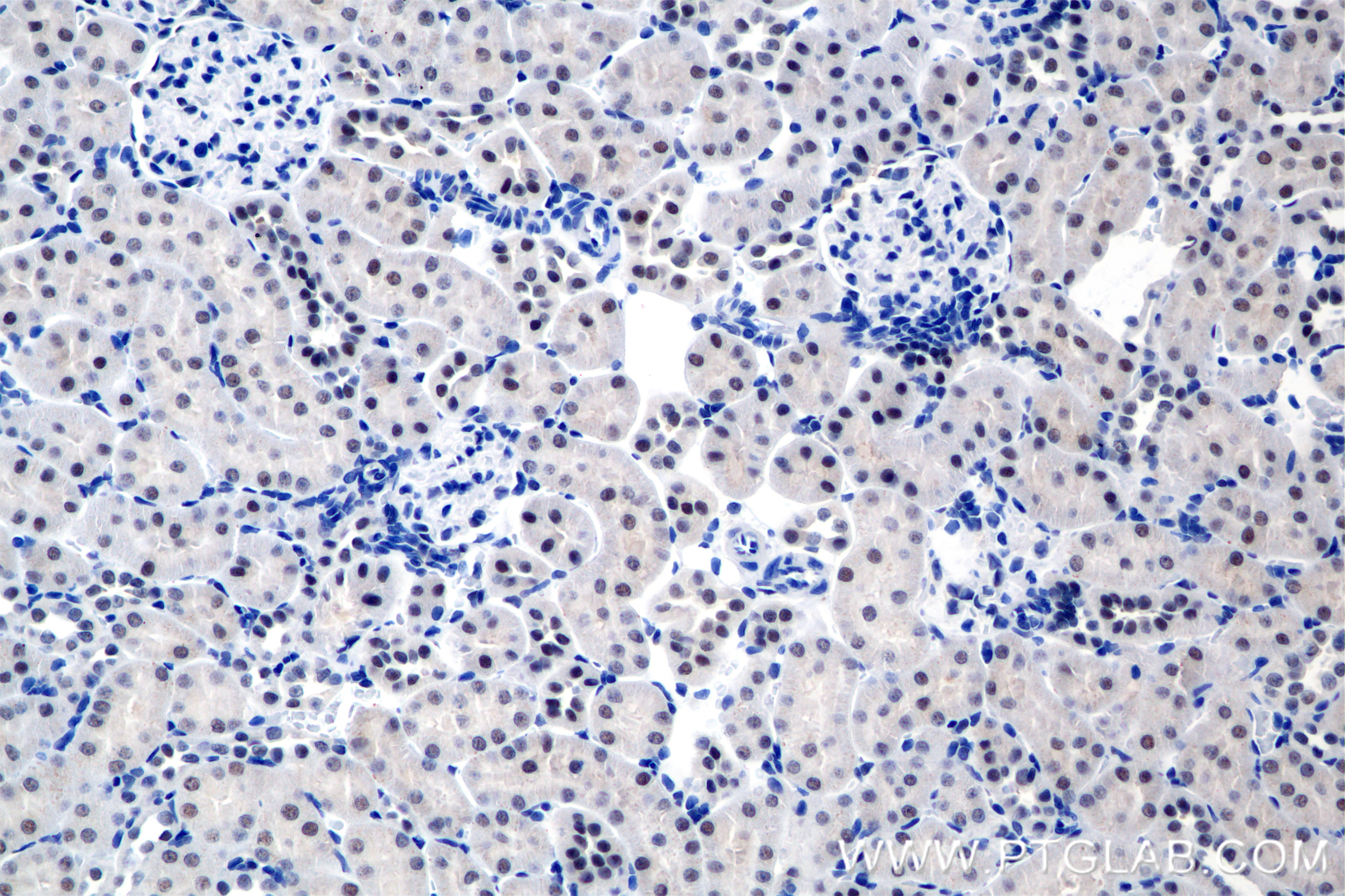 IHC staining of rat kidney using 86600-3-RR