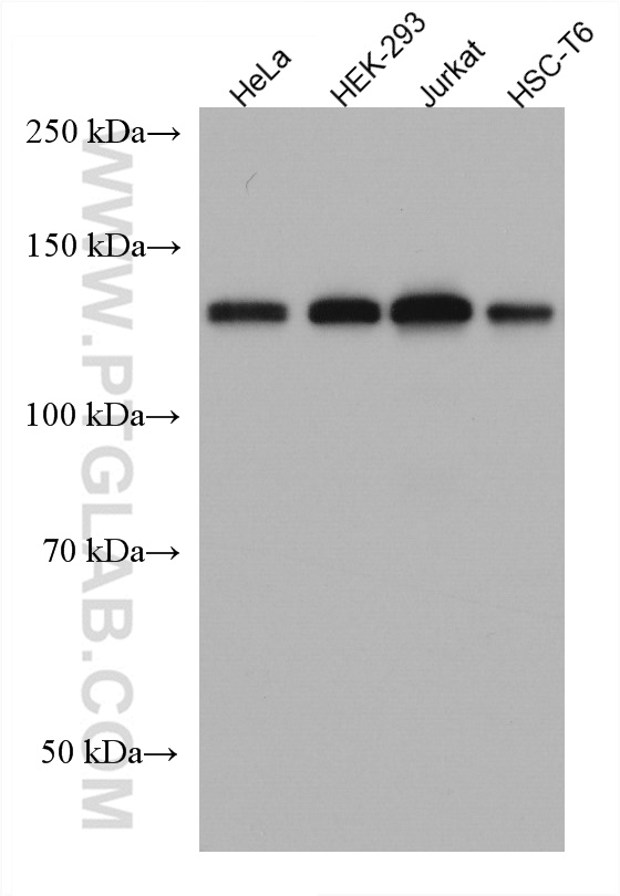 WB analysis using 67392-1-Ig