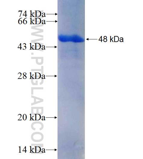 PPP4R1 fusion protein Ag26405 SDS-PAGE