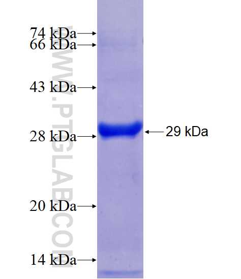 PPP4R2 fusion protein Ag18165 SDS-PAGE PPP4R2 fusion protein Ag18165 SDS-PAGE
