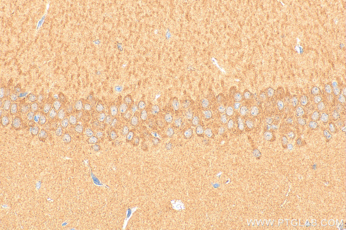IHC staining of mouse brain using 20124-1-AP
