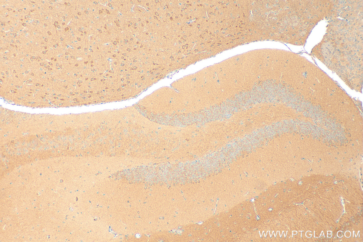 IHC staining of mouse brain using 20124-1-AP