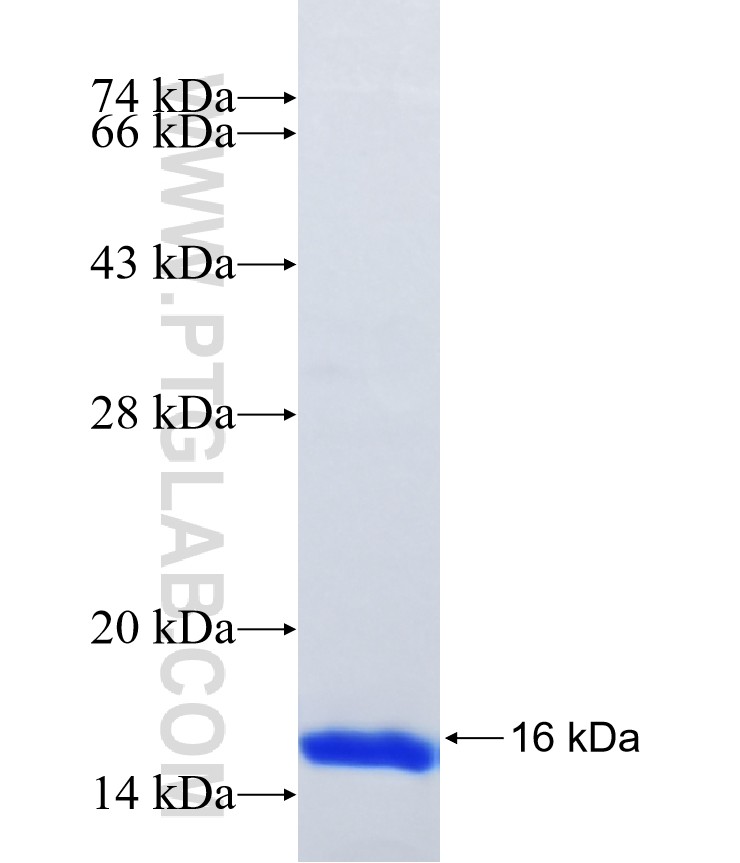 PPP4R4 fusion protein Ag17100 SDS-PAGE PPP4R4 fusion protein Ag17100 SDS-PAGE