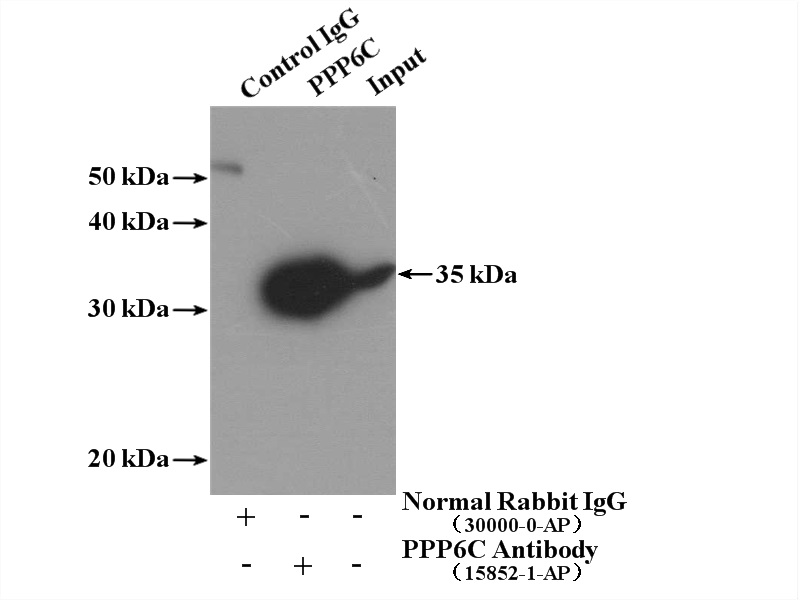 IP experiment of mouse testis using 15852-1-AP