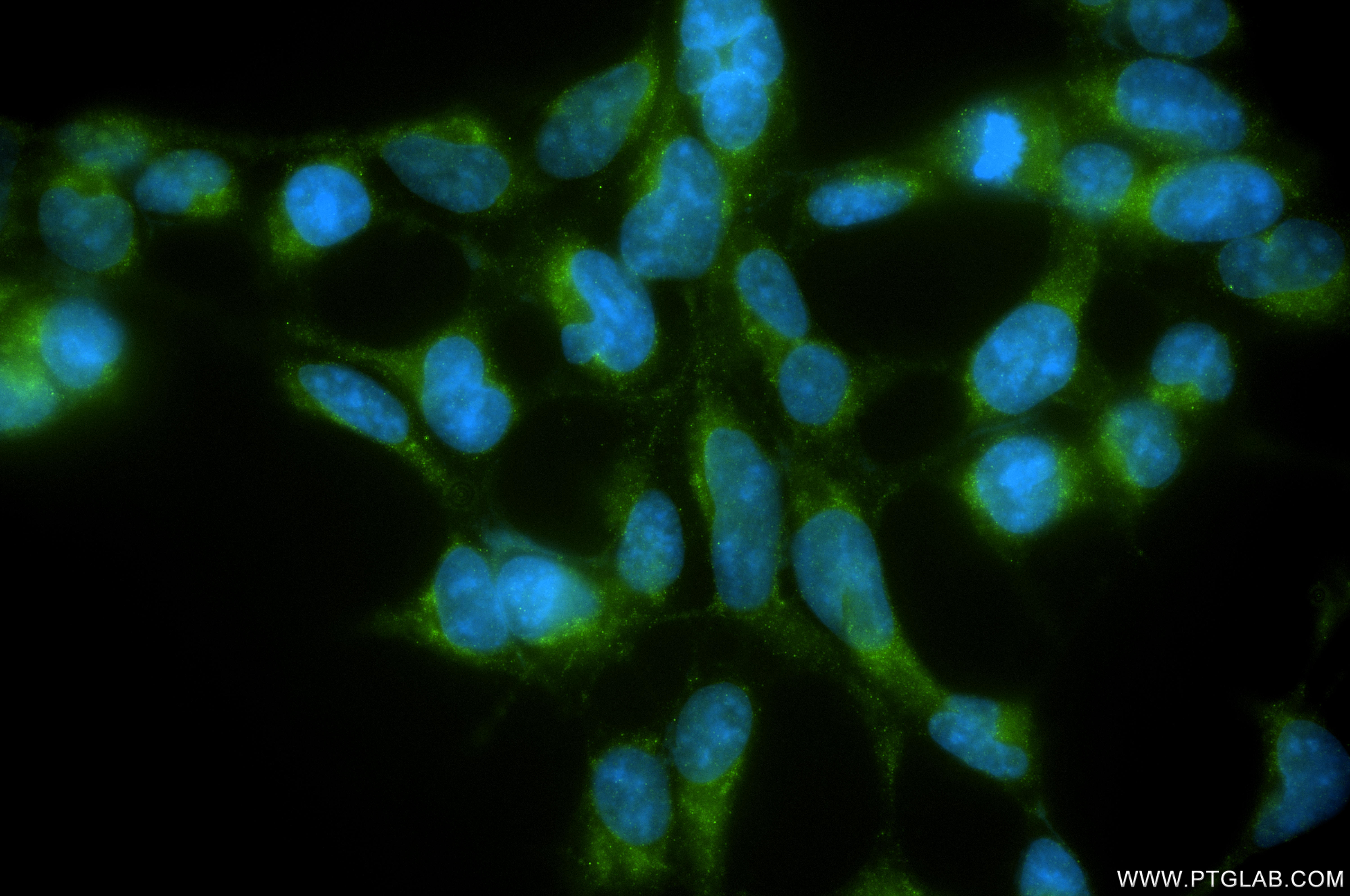 IF Staining of HEK-293 using 87155-1-RR IF Staining of HEK-293 using 87155-1-RR