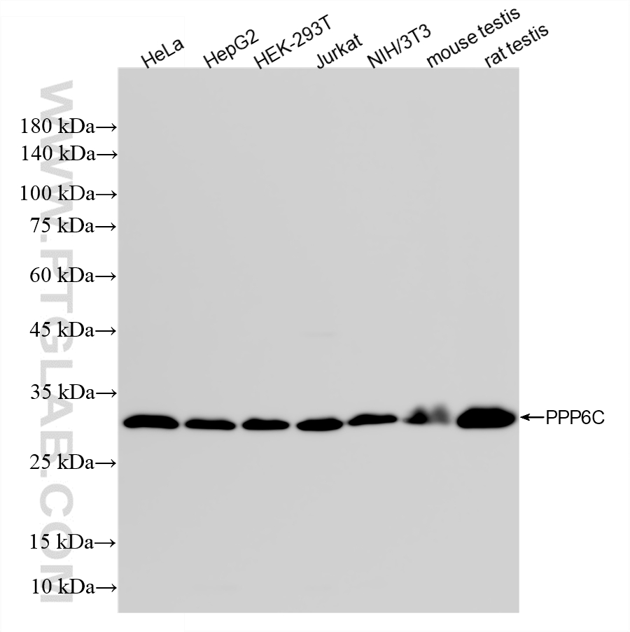 WB analysis using 87155-1-RR WB analysis using 87155-1-RR