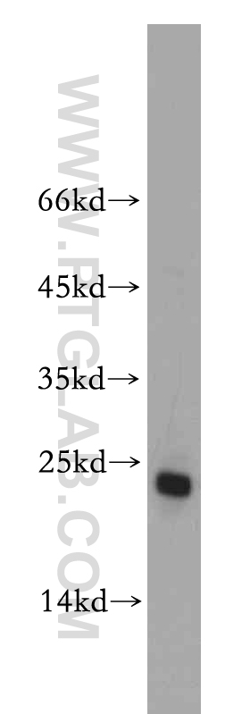 WB analysis of HeLa using 20517-1-AP