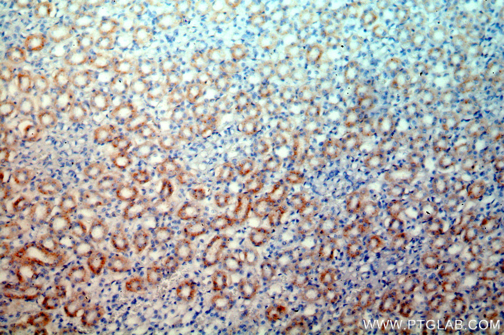 IHC staining of human kidney using 10887-1-AP