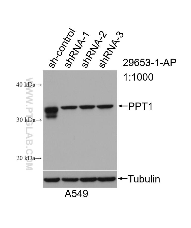 WB analysis of A549 using 29653-1-AP