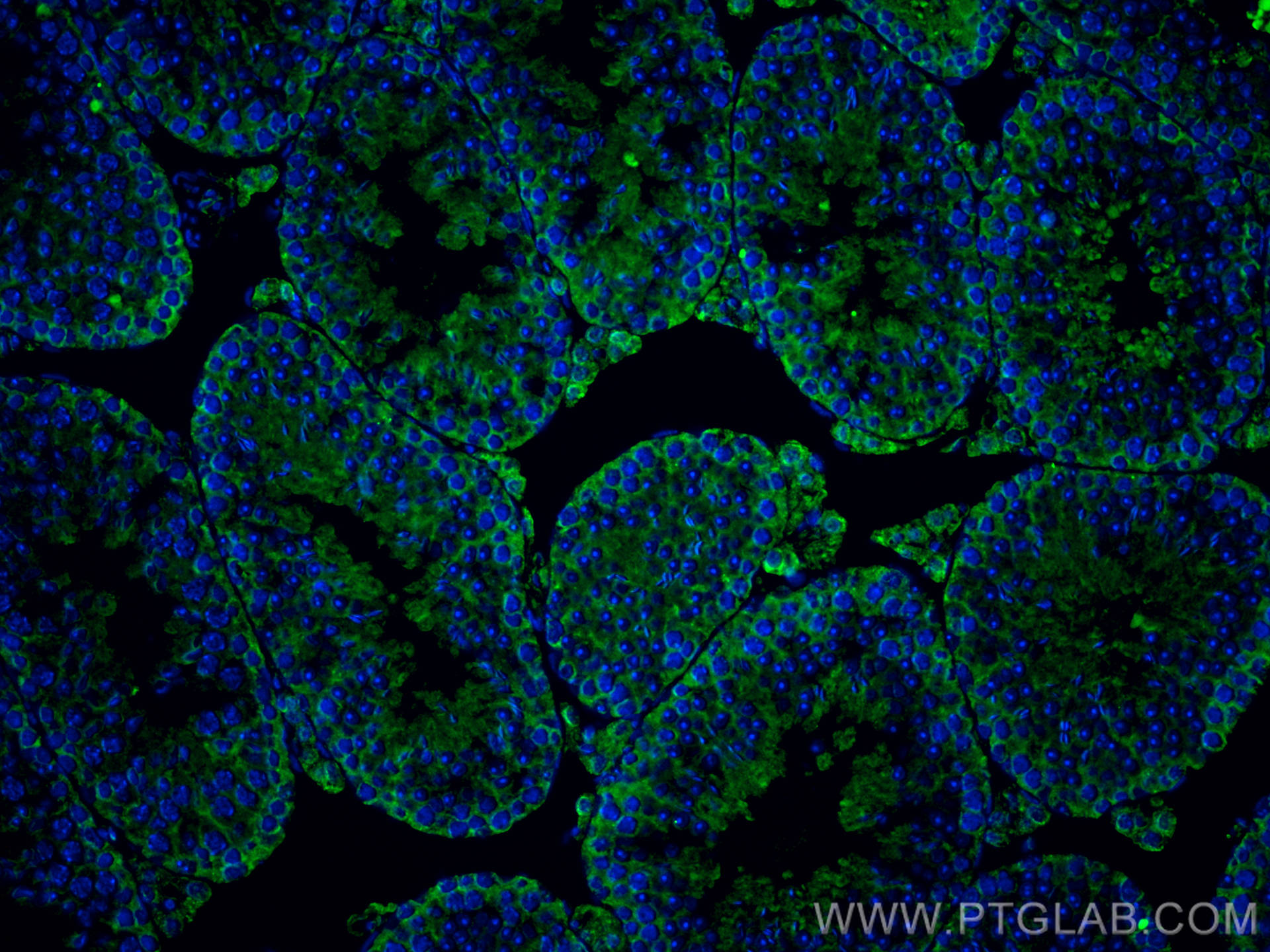 IF Staining of mouse testis using 67699-1-Ig