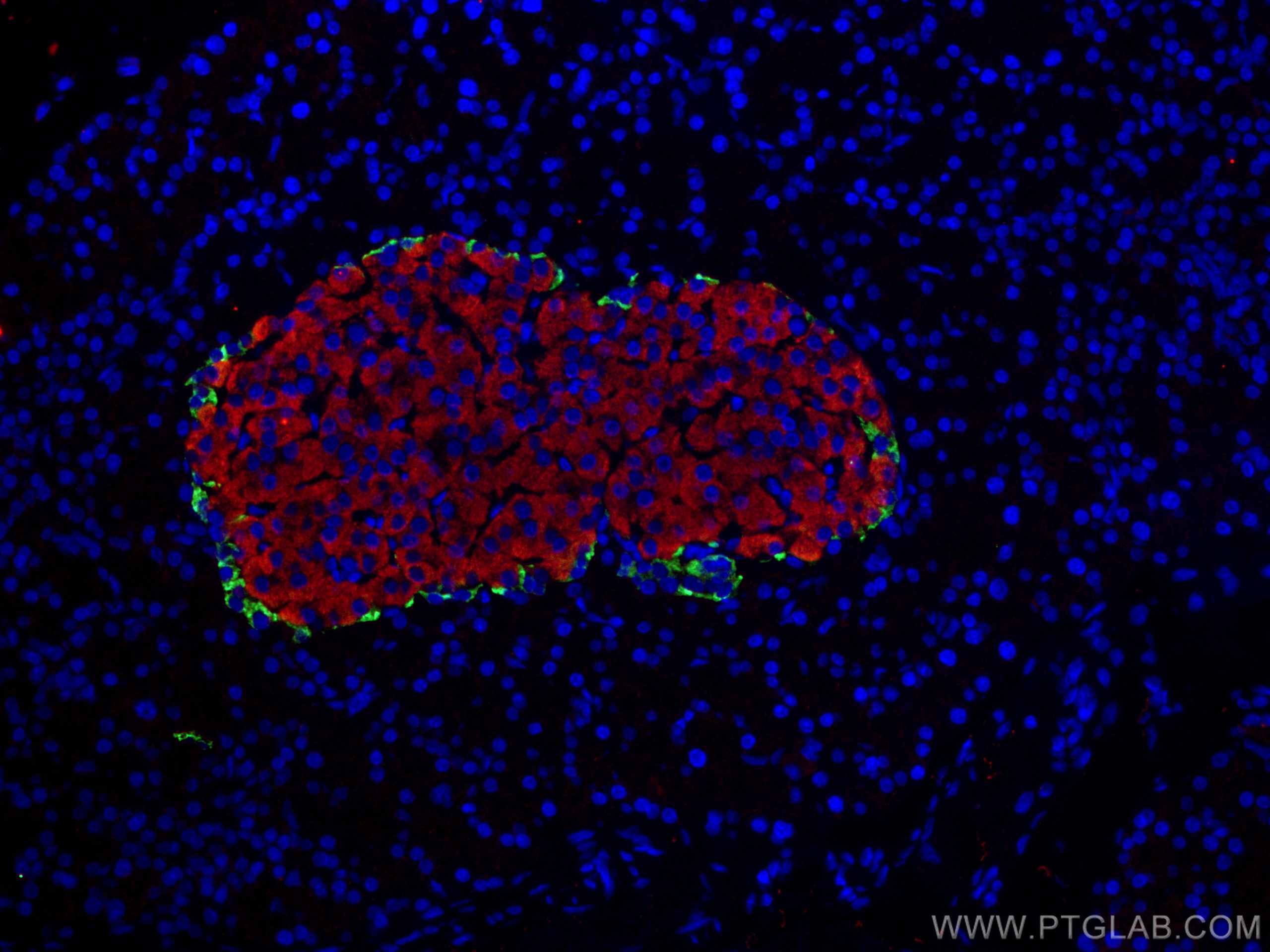 IF Staining of rat pancreas using 15493-1-AP