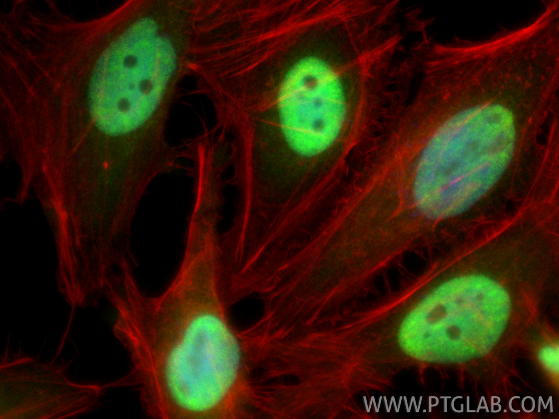 Immunofluorescent analysis of (4% PFA) fixed HeLa cells using PQBP1 antibody (16264-1-AP) at dilution of 1:400 and CoraLite®488-Conjugated Goat Anti-Rabbit IgG(H+L) (<a class='green' href='/productredirect?CatalogNo=SA00013-2' target='_blank'>SA00013-2</a>), CL594-phalloidin (red). IF Staining of HeLa using 16264-1-AP