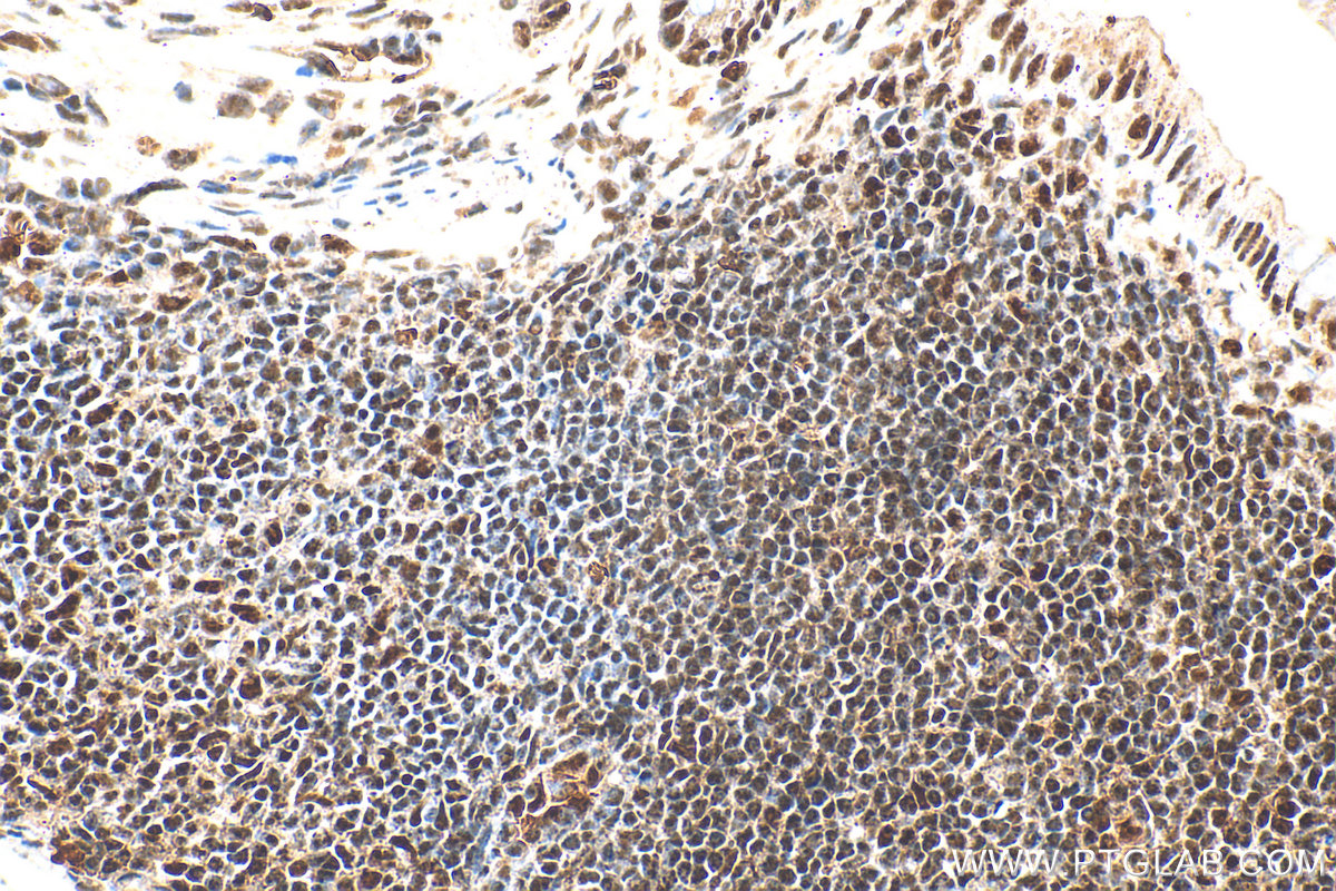 Immunohistochemical analysis of paraffin-embedded mouse colon tissue slide using 16264-1-AP (PQBP1 antibody) at dilution of 1:1000 (under 40x lens). Heat mediated antigen retrieval with Tris-EDTA buffer (pH 9.0). IHC staining of mouse colon using 16264-1-AP