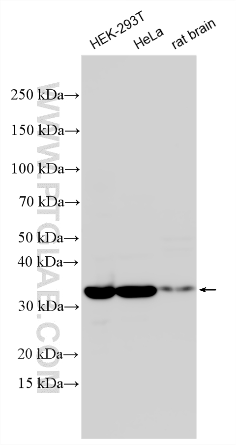 Various lysates were subjected to SDS PAGE followed by western blot with 16264-1-AP (PQBP1 antibody) at dilution of 1:10000 incubated at room temperature for 1.5 hours. WB analysis using 16264-1-AP