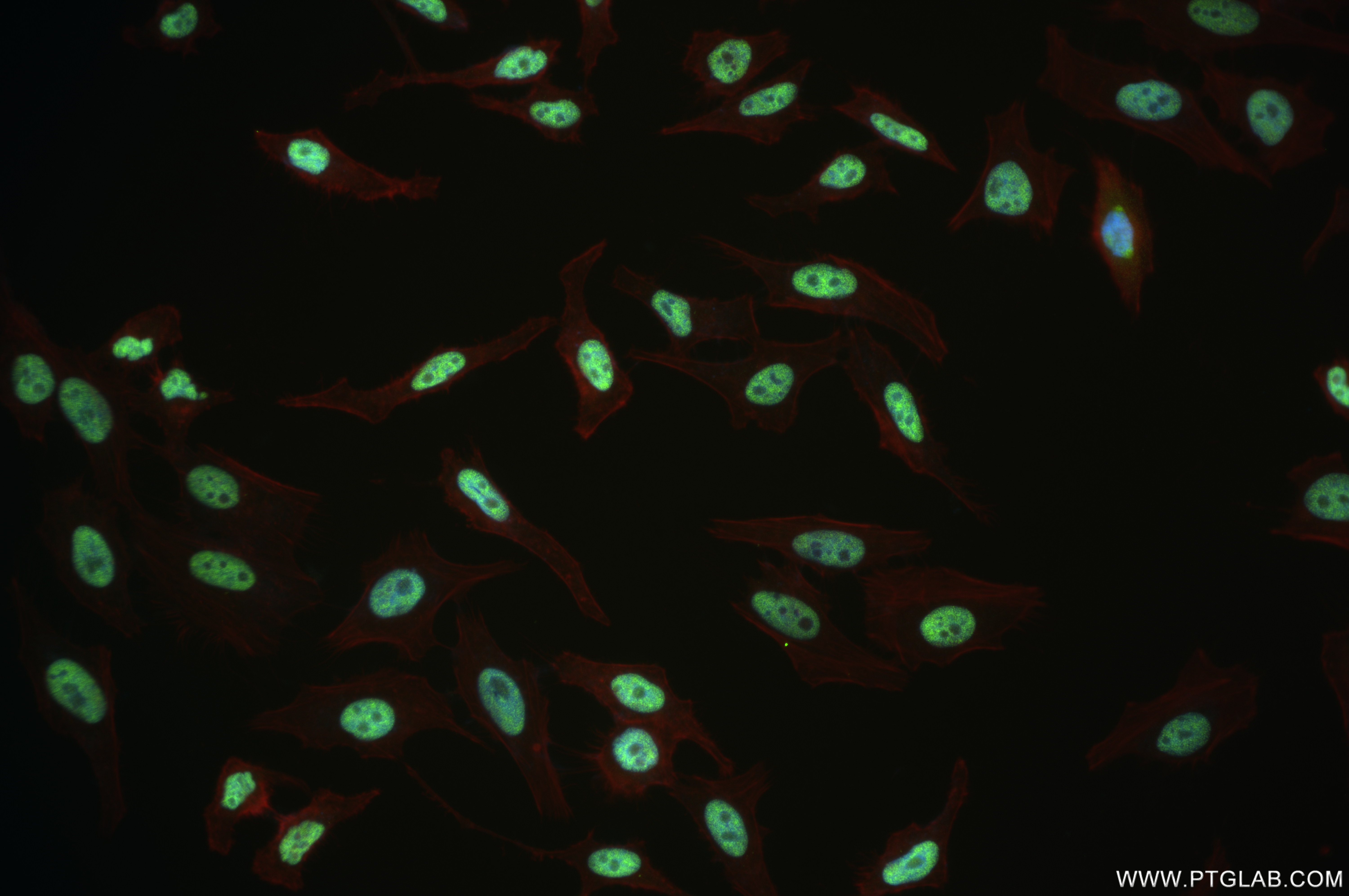 IF Staining of HeLa using 84491-6-RR (same clone as 84491-6-PBS)