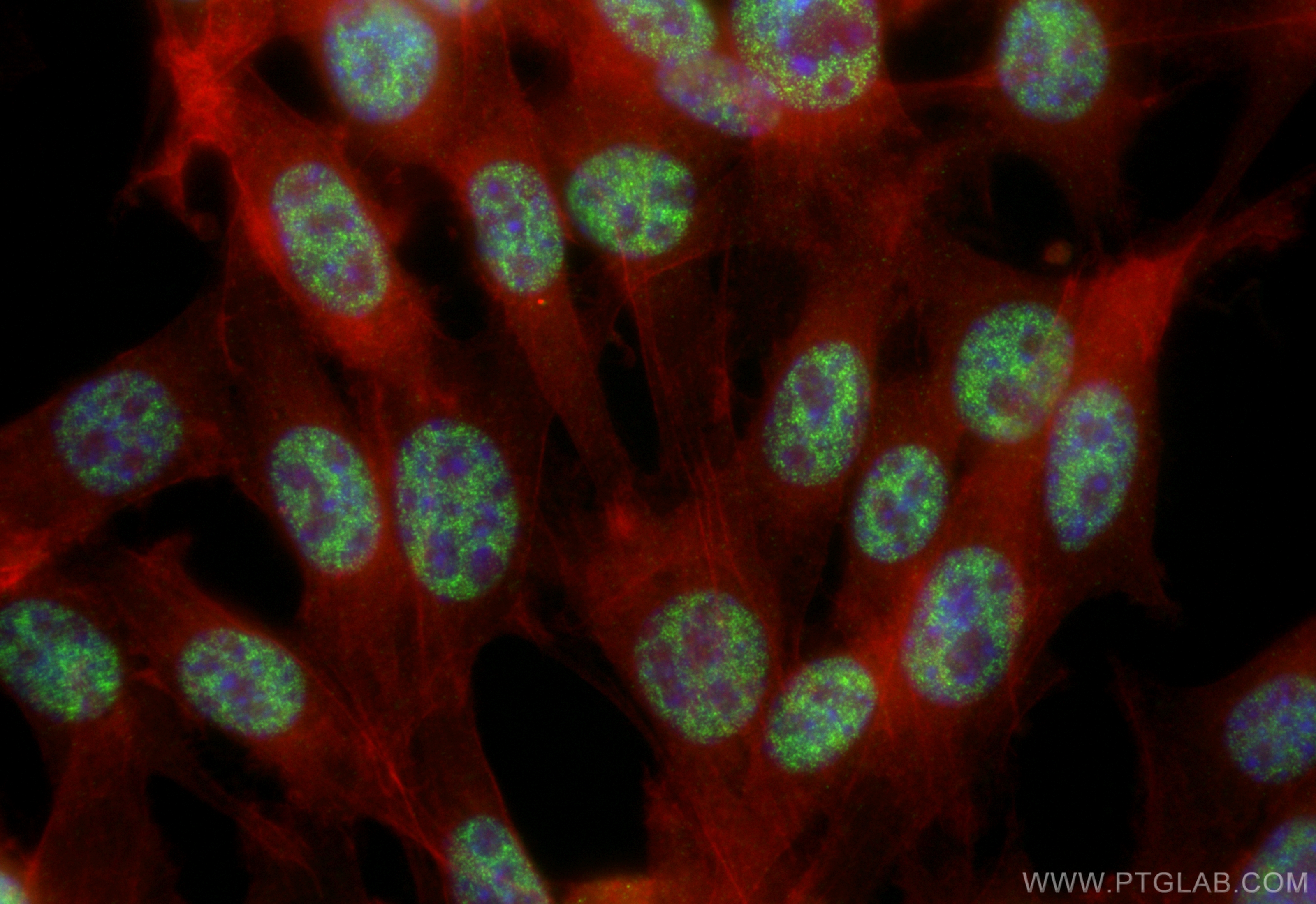 IF Staining of NIH/3T3 using 84491-6-RR