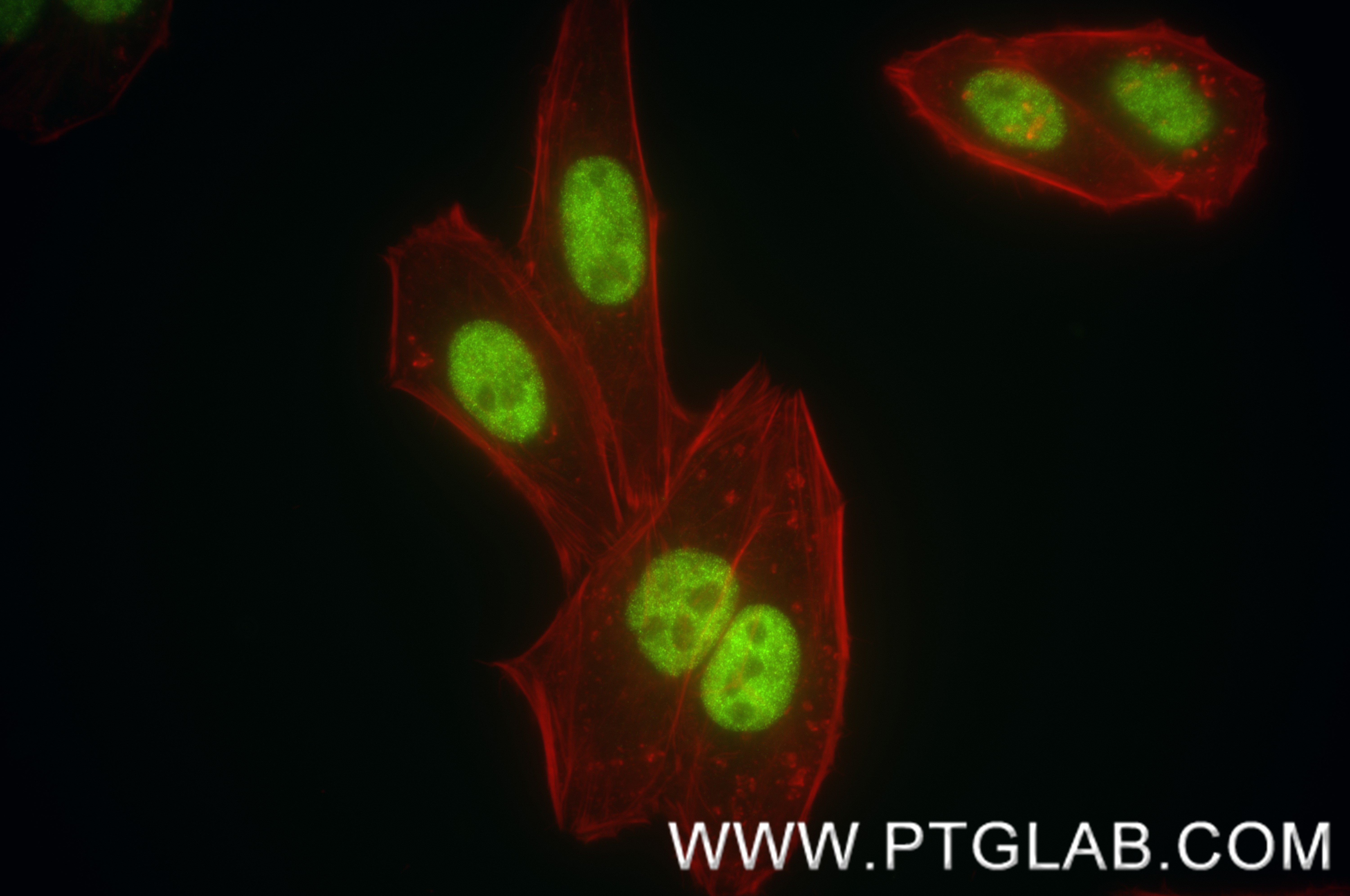 IF Staining of HeLa using 84491-6-RR (same clone as 84491-6-PBS)