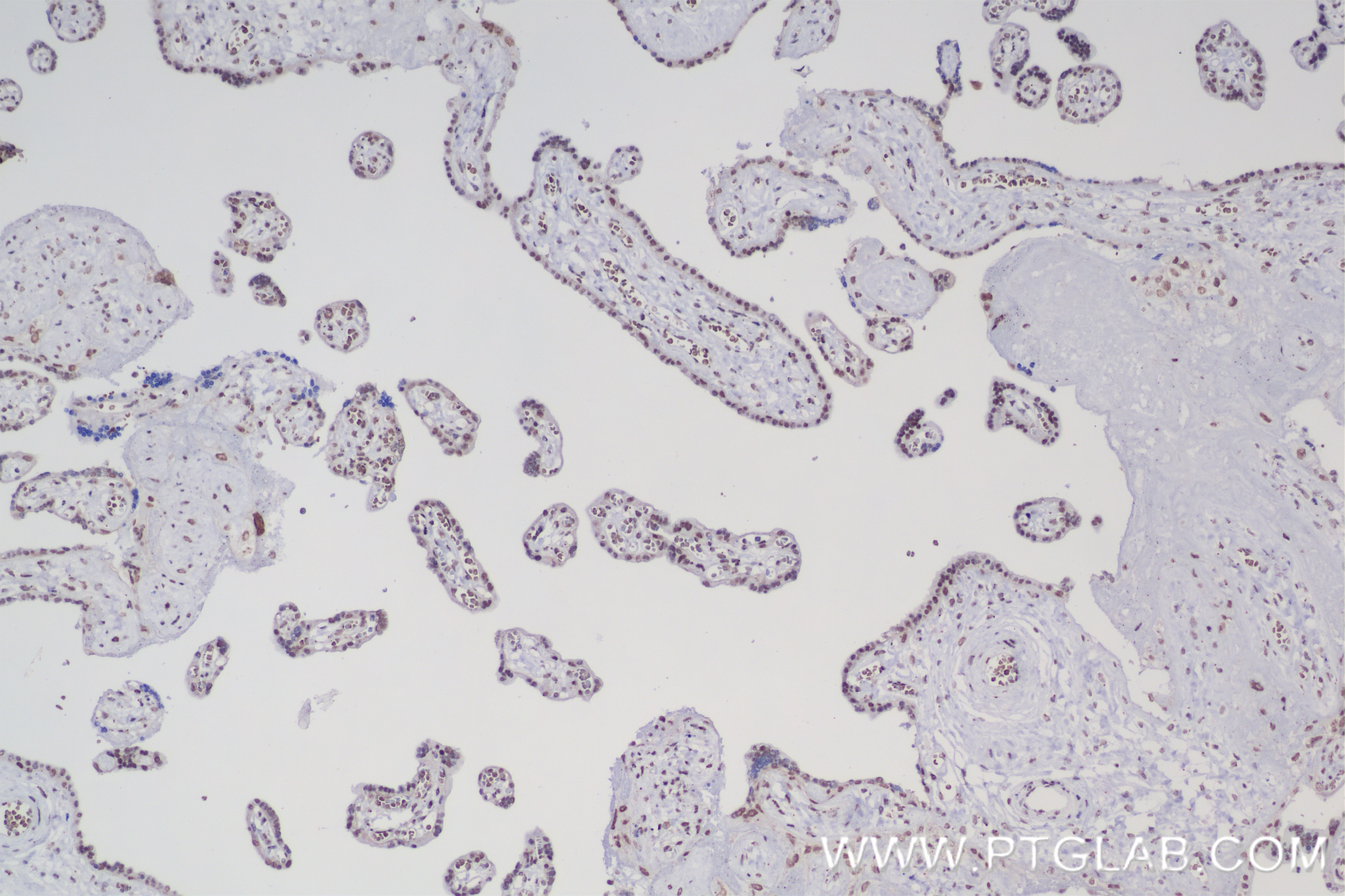 IHC staining of human placenta using 84491-6-RR