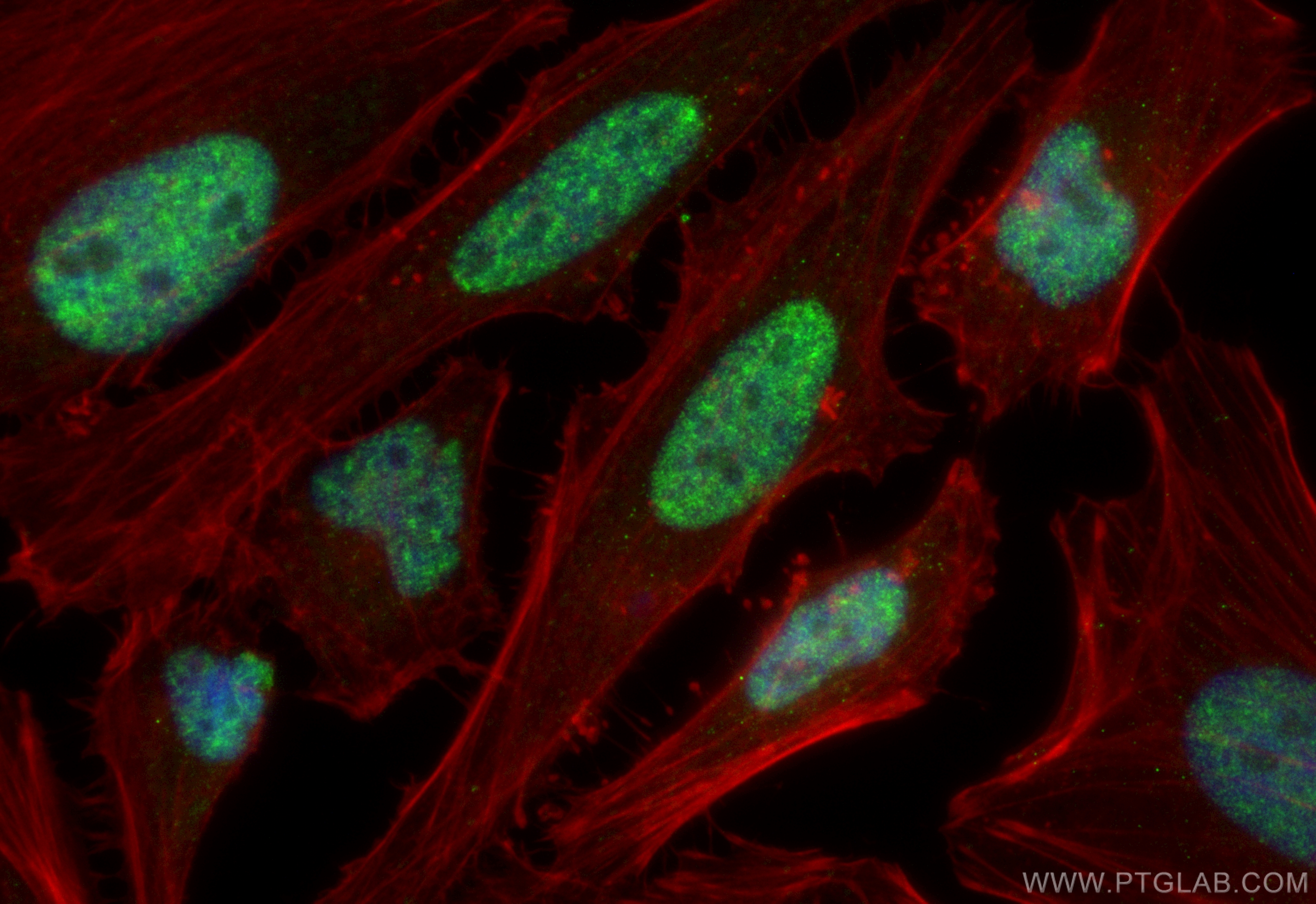 IF Staining of HeLa using CL488-84491-6