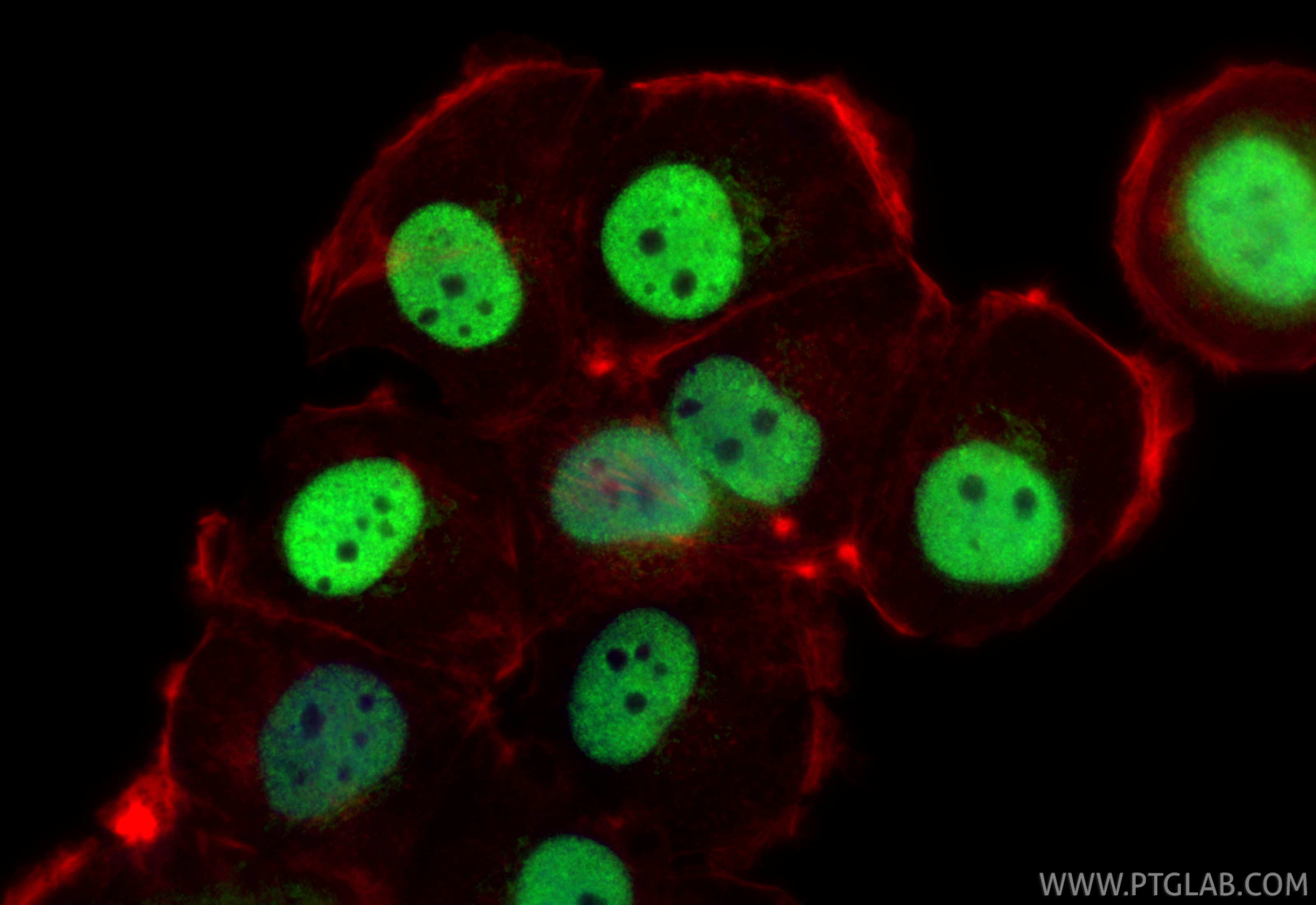 IF Staining of T-47D using 25871-1-AP IF Staining of T-47D using 25871-1-AP