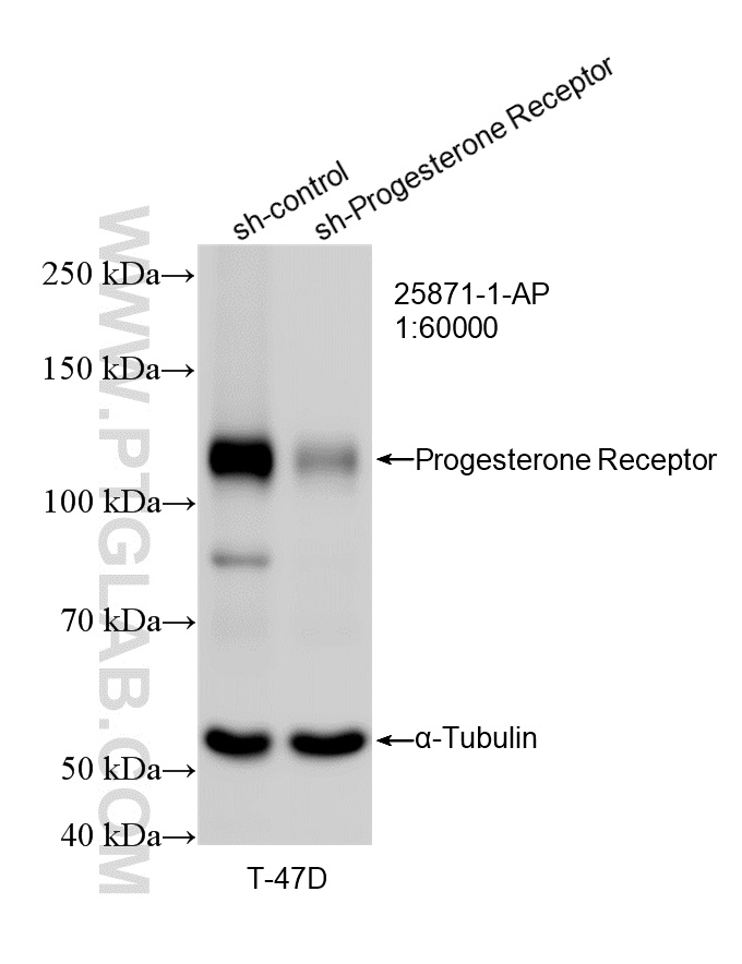 WB analysis of T-47D using 25871-1-AP