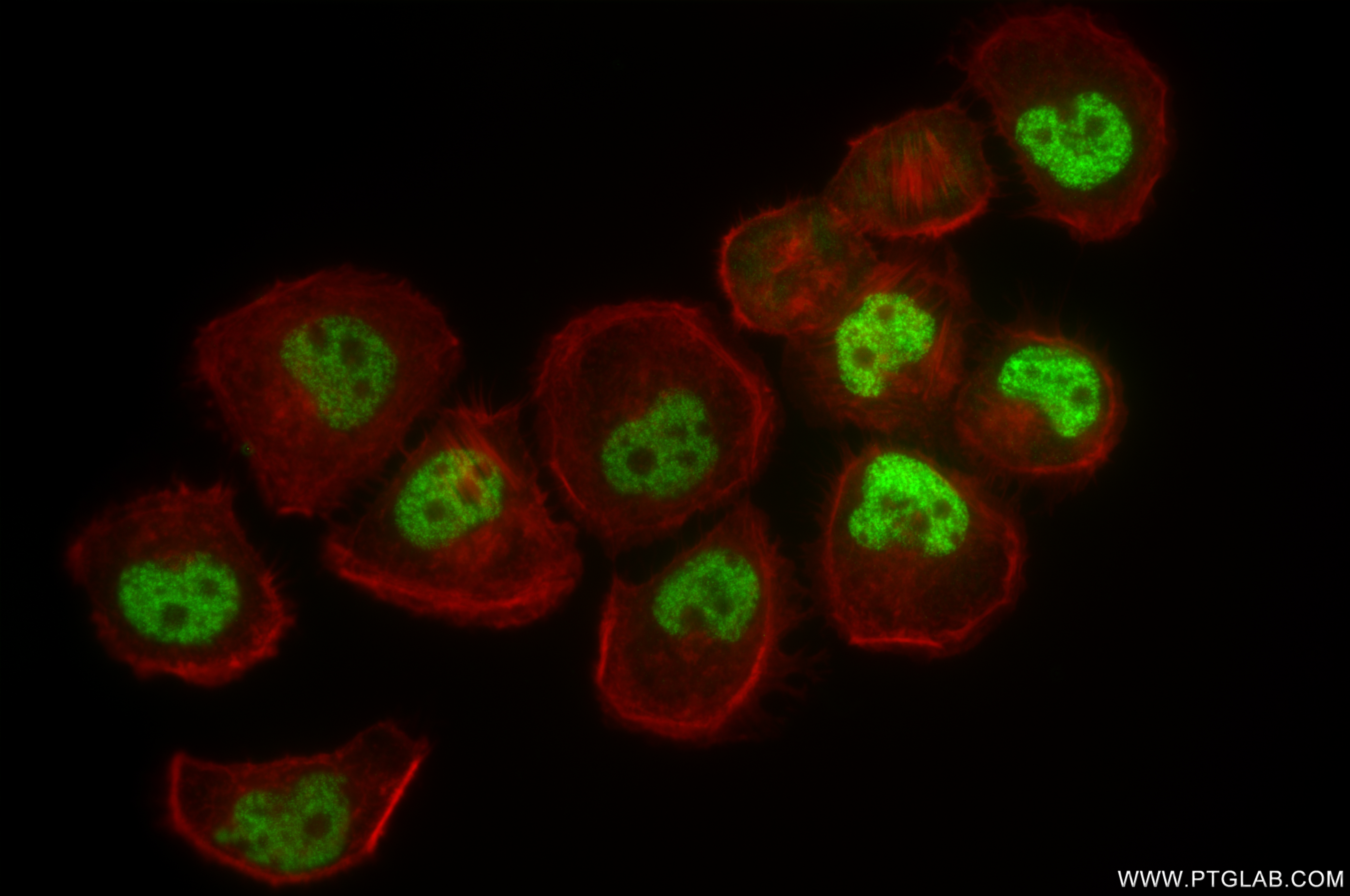 IF Staining of T-47D using 85112-5-RR