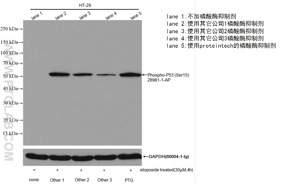 使用不同公司的磷酸酶抑制剂分别制备经etoposide处理的HT-29细胞样品，经SDS-PAGE电泳后，使用Phospho-P53(Ser15)(28961-1-AP)抗体以1:2000稀释液在37℃下孵育1小时进行免疫印迹。实验完成后剥离膜并用GAPDH（60004-1-Ig)抗体作为对照重新印迹。