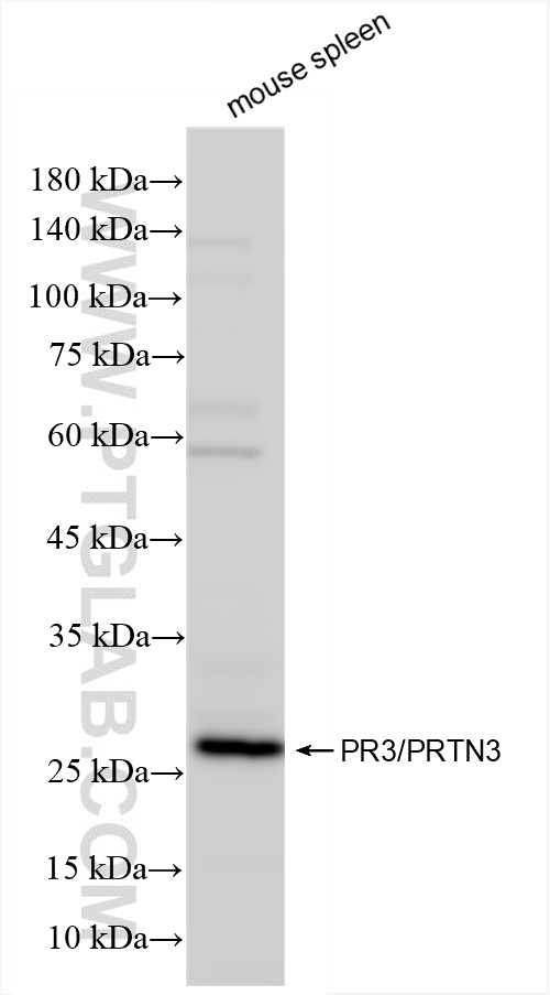 WB analysis of mouse spleen using 86384-3-RR