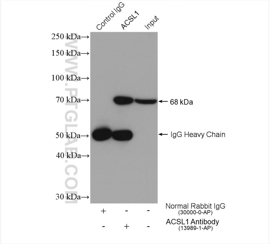 IP result of anti-ACSL1(IP:13989-1-AP, 4 μg; Detection:13989-1-AP 1:1000) with mouse liver tissue lysate 3040 μg.