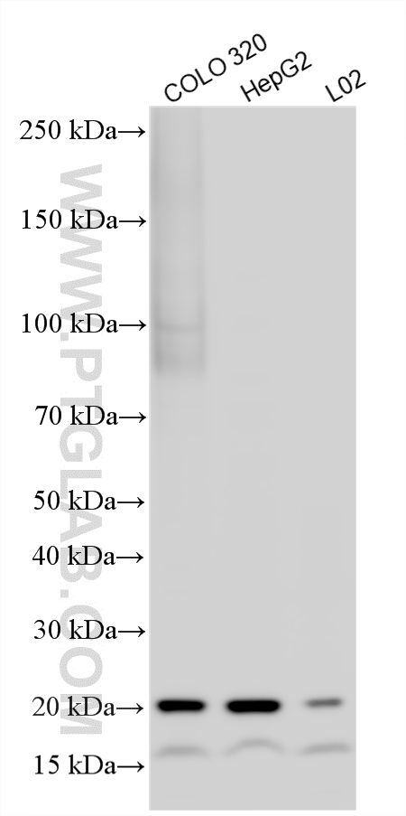 WB analysis using 11932-1-AP WB analysis using 11932-1-AP