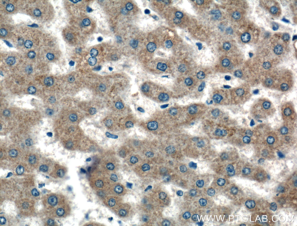 IHC staining of human liver using 21097-1-AP