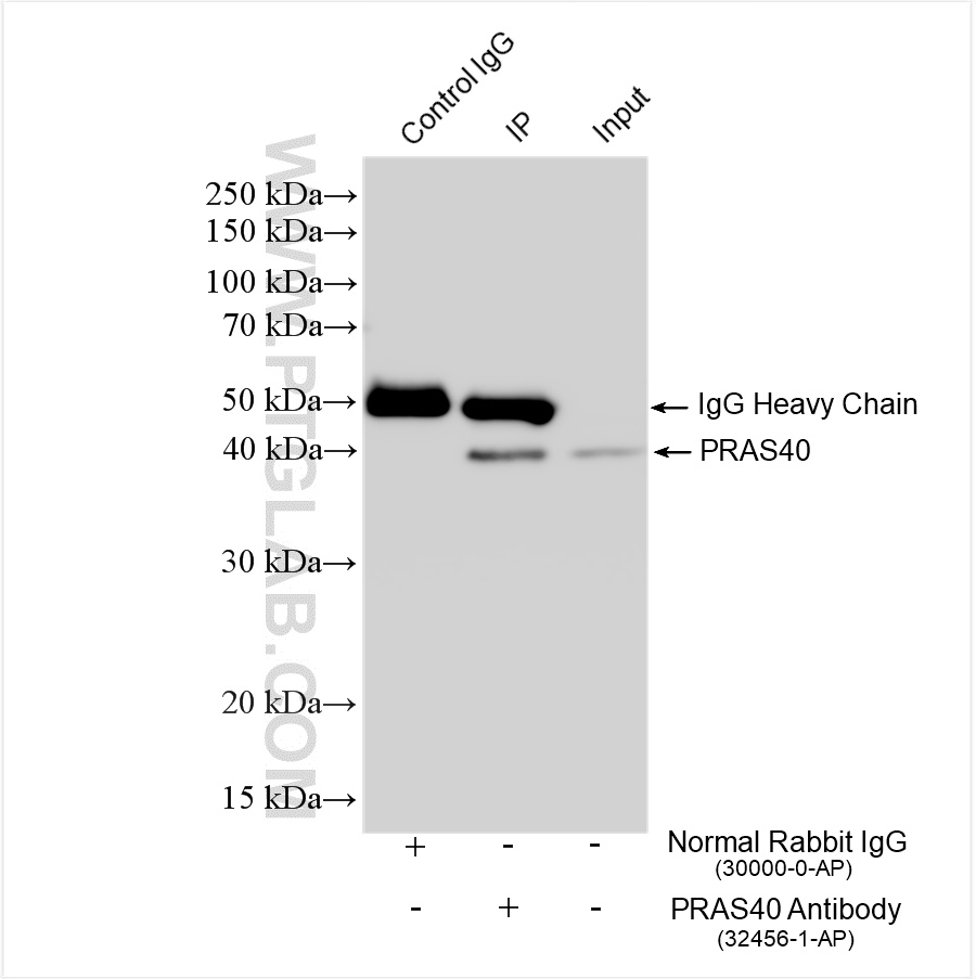 IP experiment of HeLa using 32456-1-AP