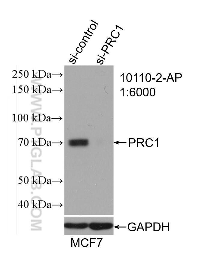 WB analysis of MCF-7 using 10110-2-AP