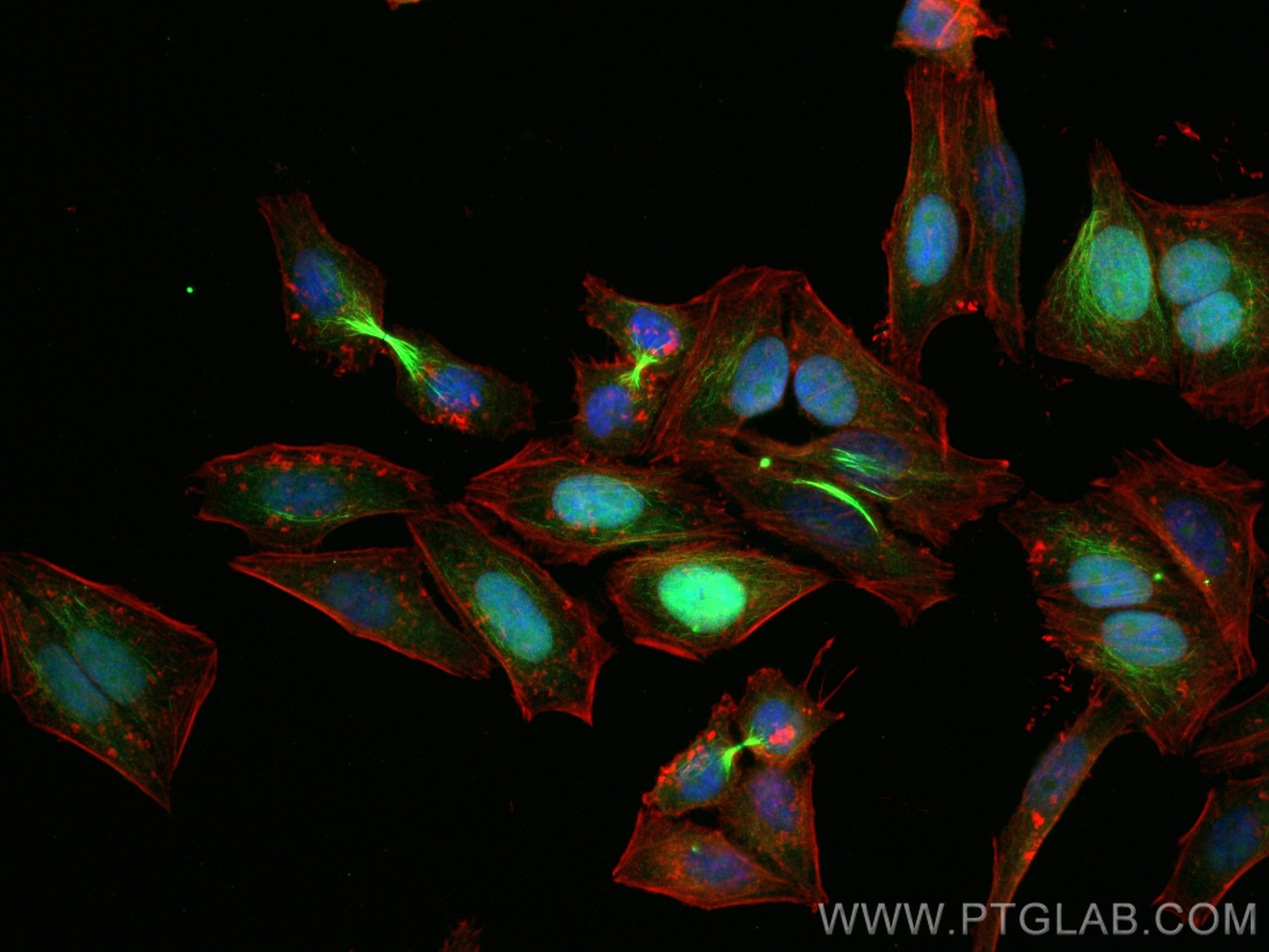 IF Staining of HepG2 using 15617-1-AP