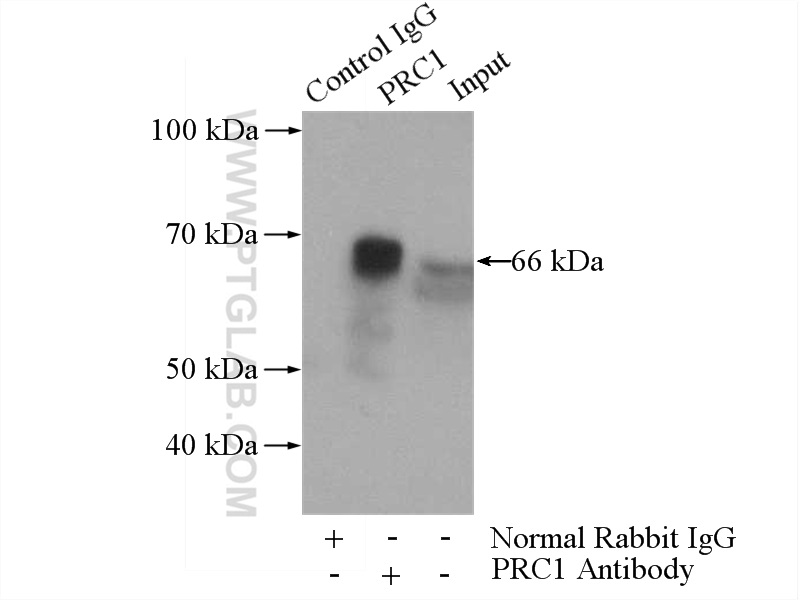 IP experiment of HEK-293 using 15617-1-AP