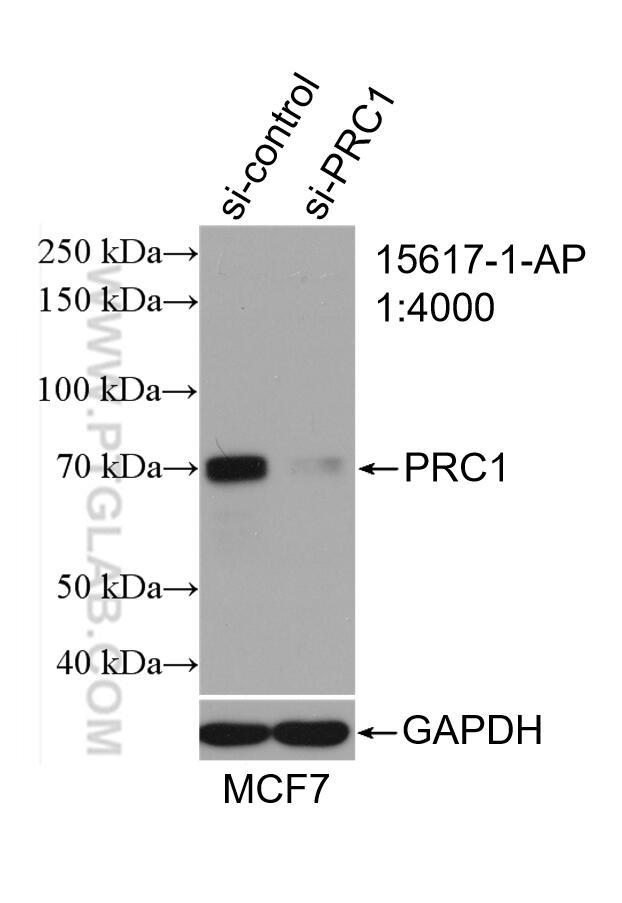 WB analysis of MCF-7 using 15617-1-AP