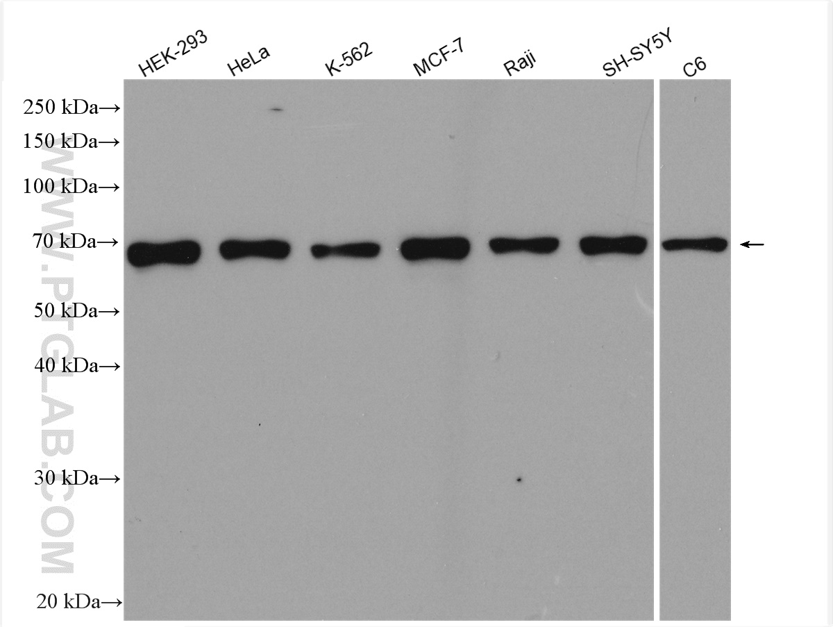 WB analysis using 15617-1-AP